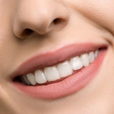 5 Sure Ways To Get Whiter Teeth