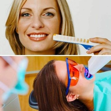 The Difference between Over-the-Counter Teeth Whitening Treatments and In-Office Dental Whitening