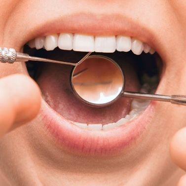 What Causes Gum Disease? The Symptoms and Treatments That Work